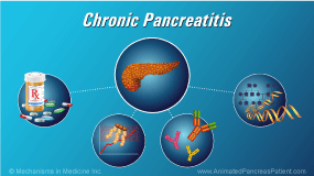 Chronic Pancreatitis