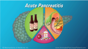 Slide Show - Acute Pancreatitis