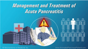 Management and Treatment of Acute Pancreatitis