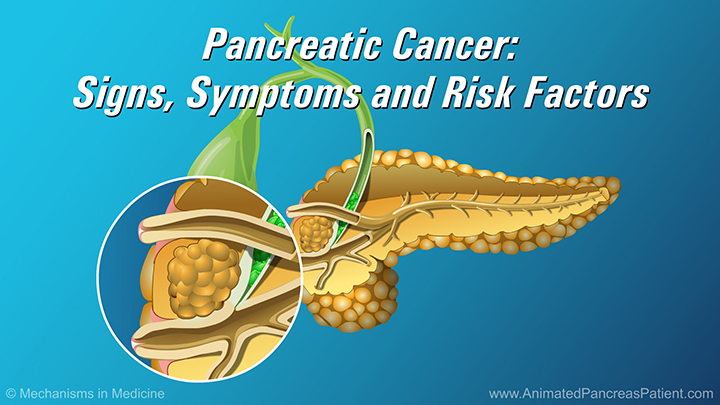 Pancreatic Cancer