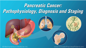 Pancreatic Cancer - Pathophysiology, Diagnosis and Staging