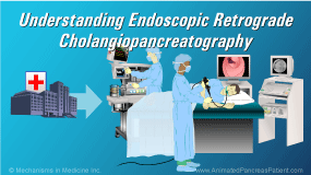 Animation - Understanding ERCP