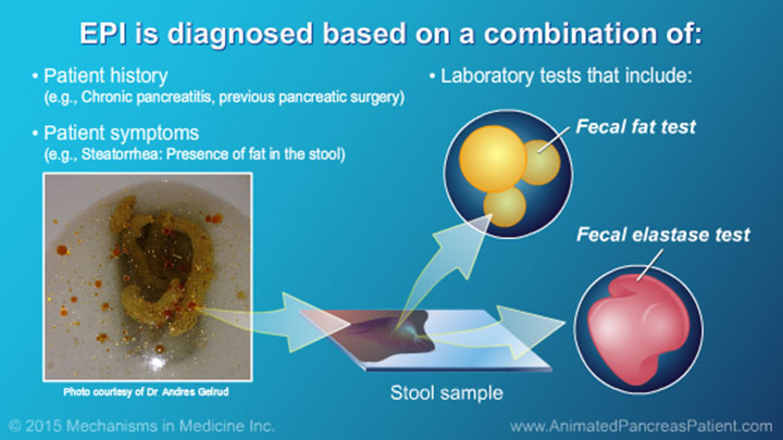 Slide Show Understanding Nutrition And The Role And Benefits Of Pert