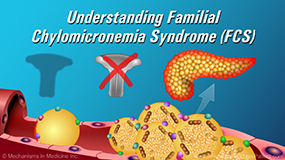 Familial Chylomicronemia Syndrome