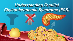 Understanding Familial Chylomicronemia Syndrome (FCS)