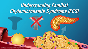 Understanding Familial Chylomicronemia Syndrome