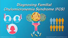 Diagnosing Familial Chylomicronemia Syndrome (FCS)