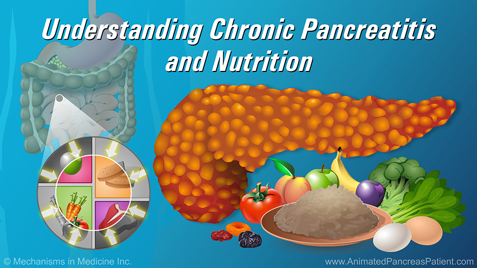 Slide Show - Understanding Chronic Pancreatitis and Nutrition