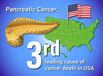 Animated Pancreas Patient Brochure