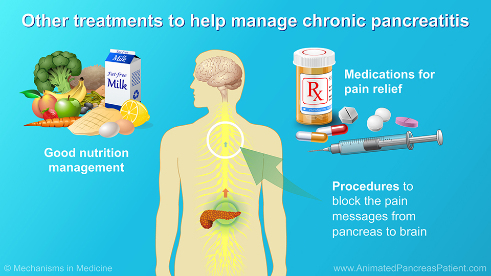 Other treatments to help manage chronic pancreatitis