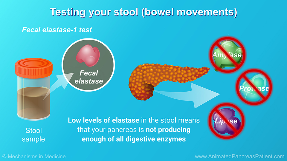 Testing your stool (bowel movements)