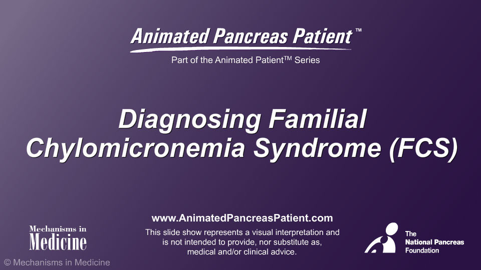Diagnosing Familial Chylomicronemia Syndrome (FCS) 