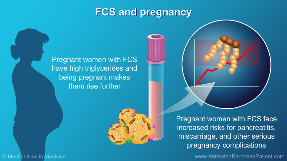 FCS and pregnancy