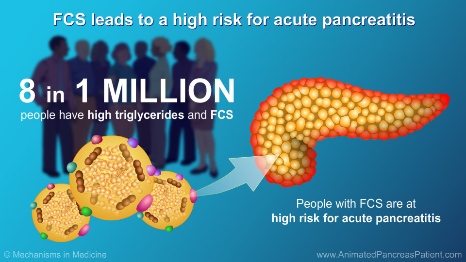 FCS leads to a high risk for acute pancreatitis