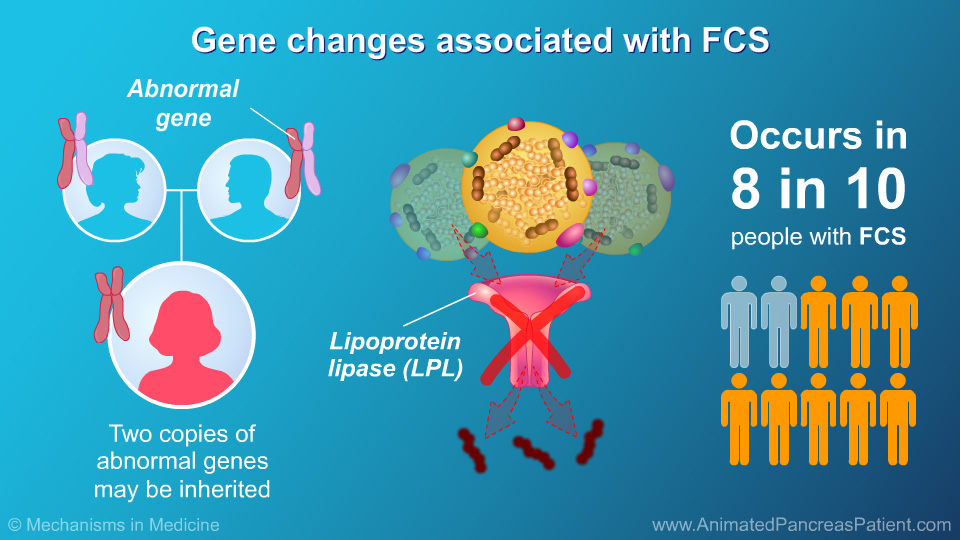 Gene changes associated with FCS