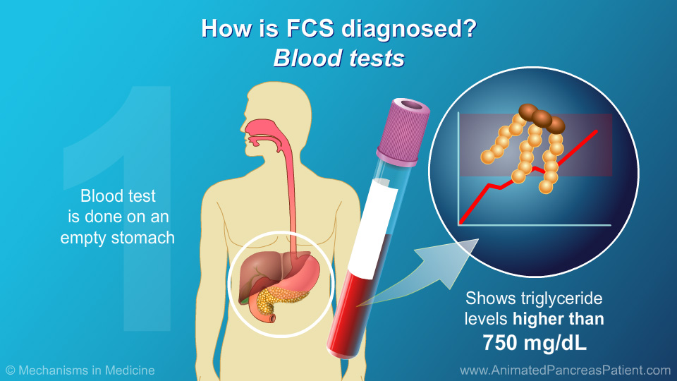 How is FCS diagnosed?