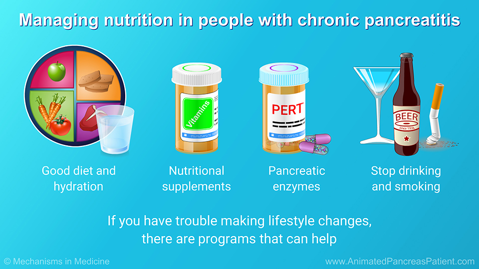 Managing nutrition in people with chronic pancreatitis