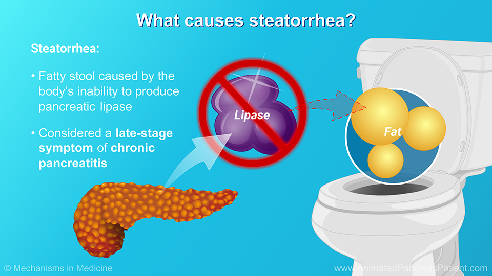 What causes steatorrhea?