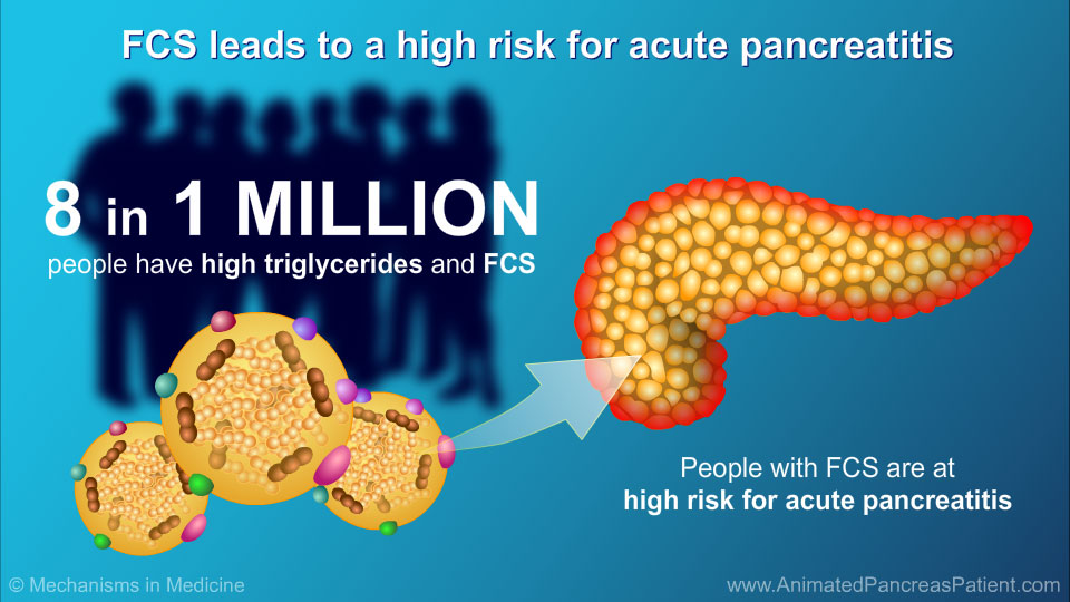 FCS leads to a high risk for acute pancreatitis