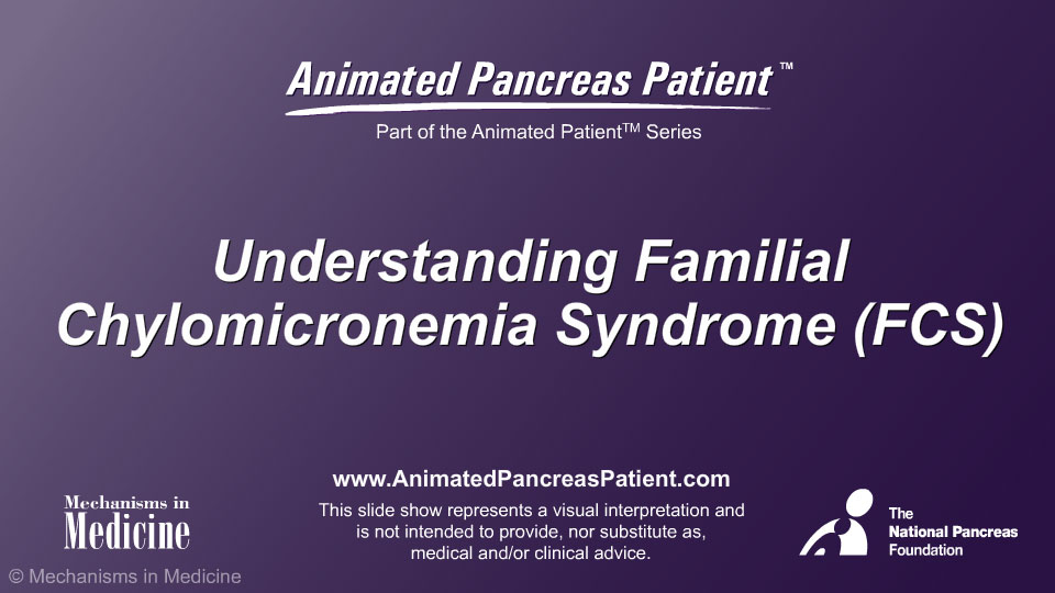 Understanding Familial Chylomicronemia Syndrome (FCS)