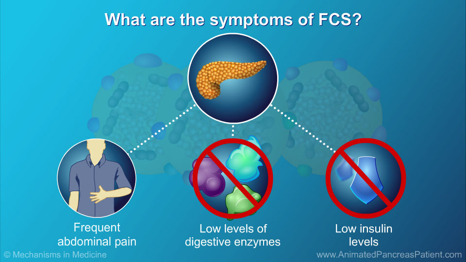 What are the symptoms of FCS? - 1