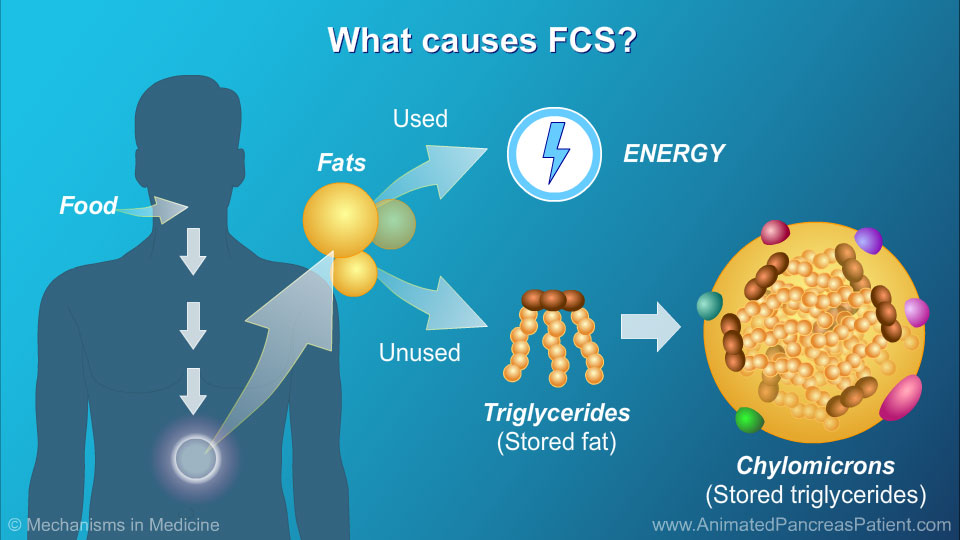 What causes FCS? - 1