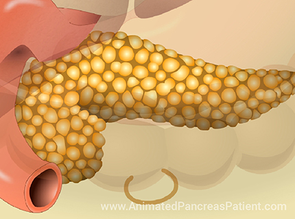 Learn about a variety of topics on pancreatic diseases through short animations